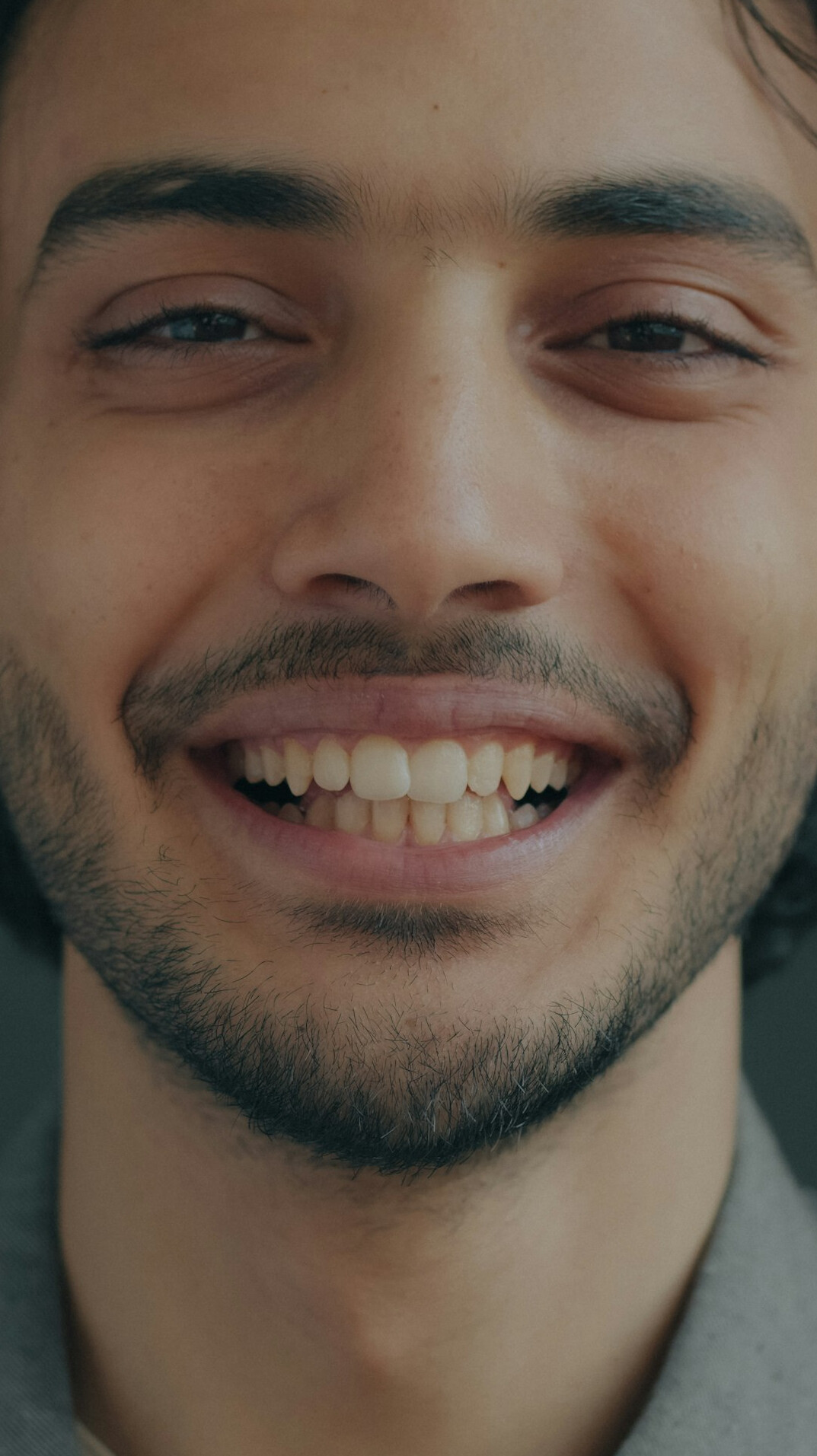 patient smiling after treatment